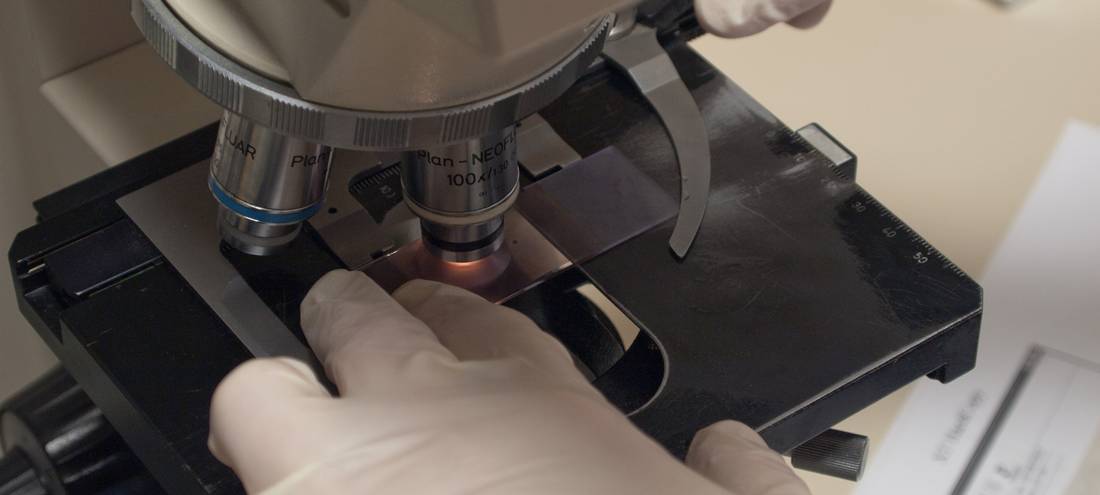 Verdacht auf Geflügelpest in Meschede