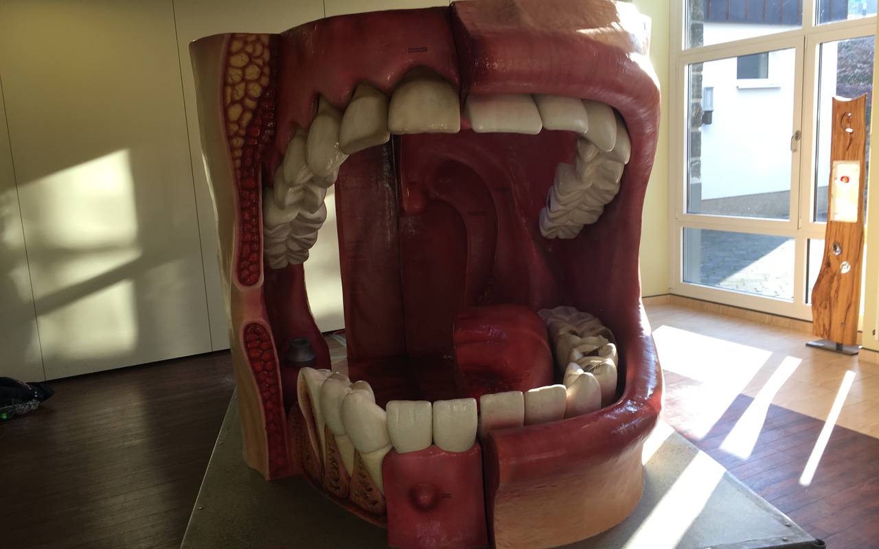 Riesenmodell einer Mundhöhle mit kariösen Zähnen.