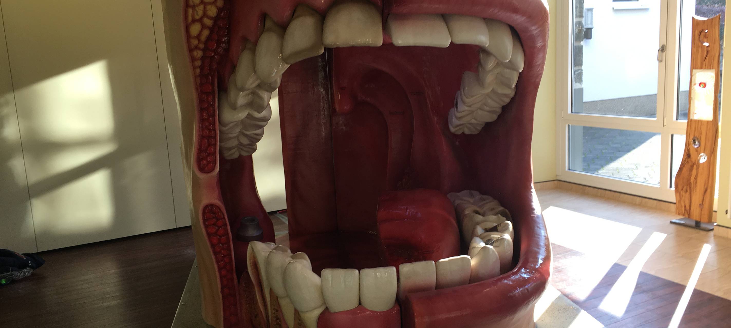 Riesenmodell einer Mundhöhle mit kariösen Zähnen.