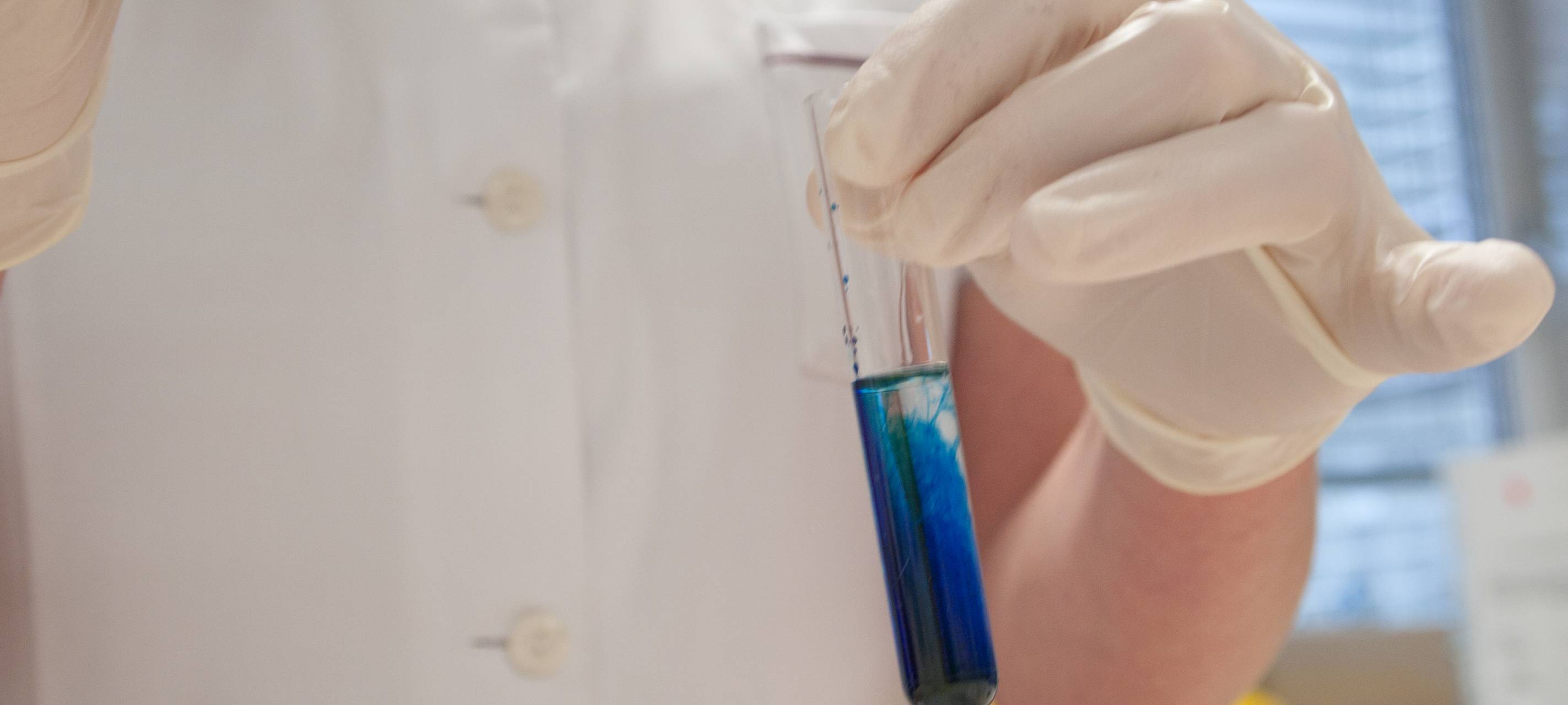 Grippesaison steuert auf Höhepunkt zu