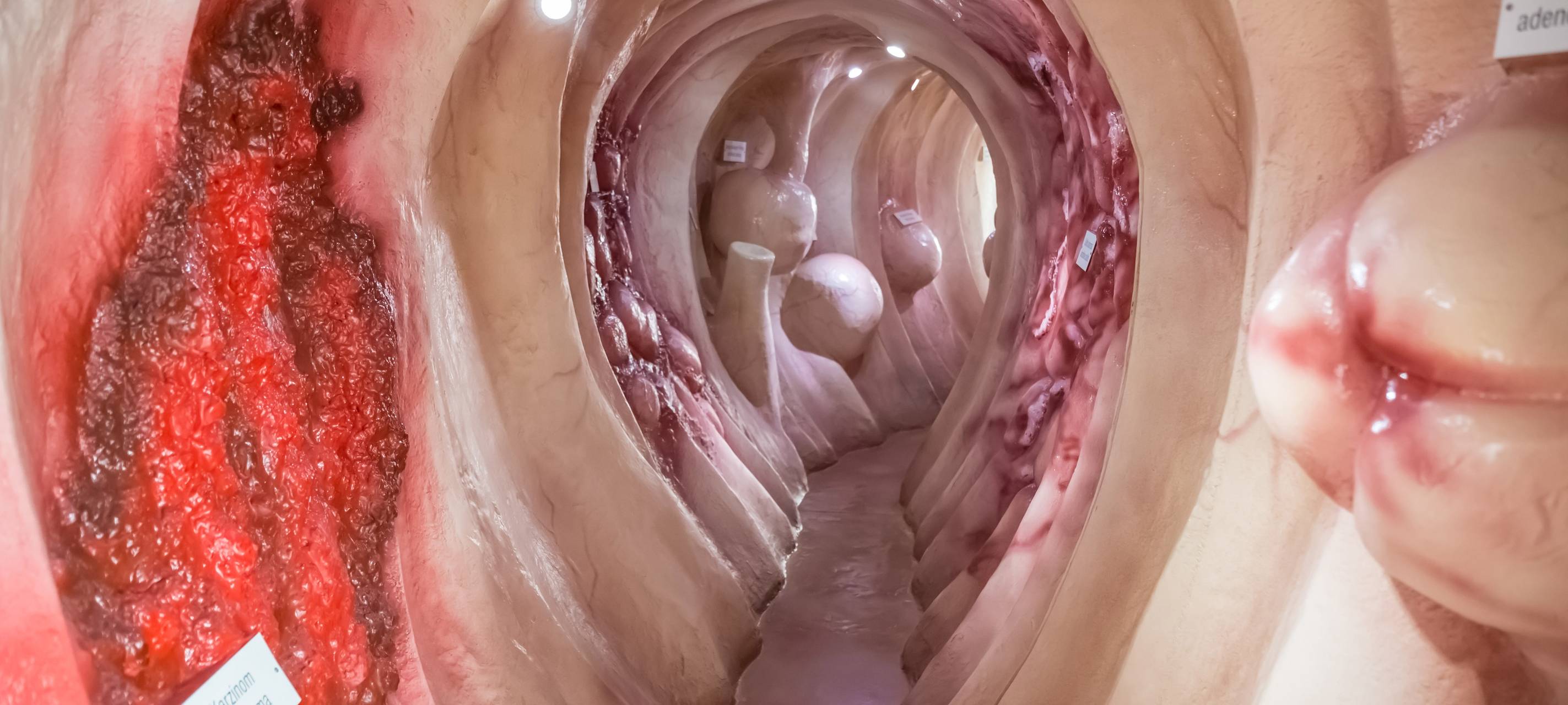 Neues Notfall- und Intensivzentrum in Hüsten gibt Einblicke