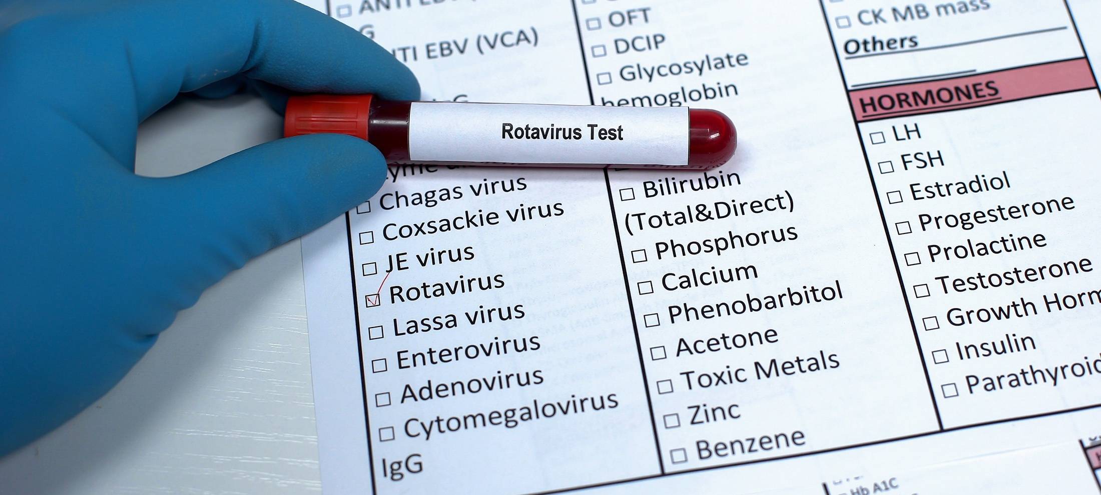 Sauerland: mehr Rotavirus-Fälle