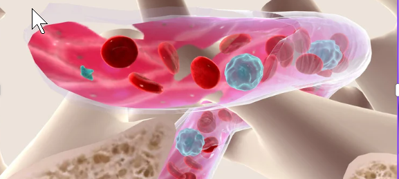 Klinikum Hochsauerland führend bei Gefäßeingriffen